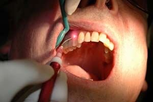 Oral Surgery